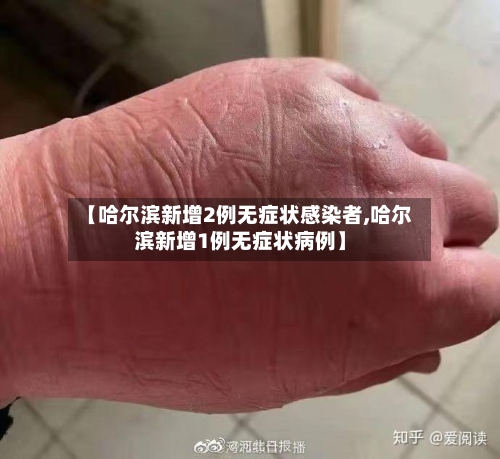 【哈尔滨新增2例无症状感染者,哈尔滨新增1例无症状病例】-第1张图片